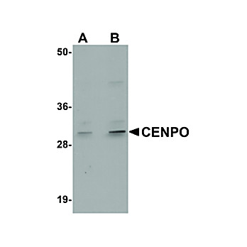 Anti-CENPO (RABBIT) Antibody, 100µg, Liquid (sterile filtered)