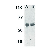 CIKS Antibody nterm 100µg