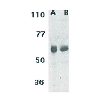 CIKS Antibody nterm 100µg
