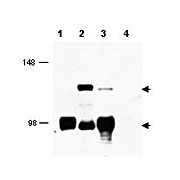 Anti-MECT1 (RABBIT) Antibody, 100µg, Liquid (sterile filtered)