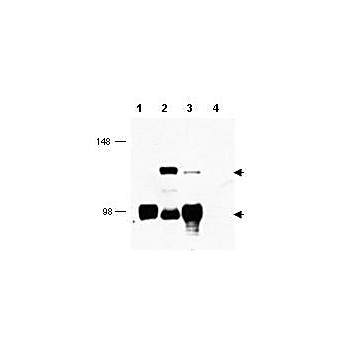 Anti-MECT1 (RABBIT) Antibody, 100µg, Liquid (sterile filtered)