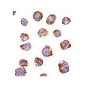 IRAK4 Antibody 100µg