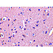 CRMP1 Antibody cterm 100µg