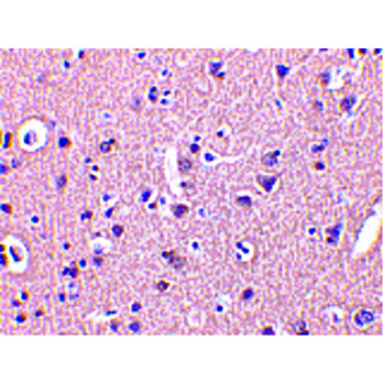 CRMP1 Antibody cterm 100µg