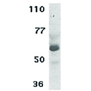 CIKS Antibody cterm 100µg
