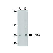 Anti-GPR3 (RABBIT) Antibody, 100µg, Liquid (sterile filtered)