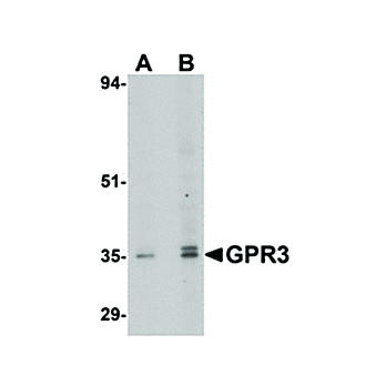 Anti-GPR3 (RABBIT) Antibody, 100µg, Liquid (sterile filtered)