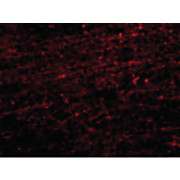 Anti-CLIP170 (RABBIT) Antibody, 100µg, Liquid (sterile filtered)