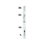Anti-IFN beta (RABBIT) Antibody, 100µg, Liquid (sterile filtered)