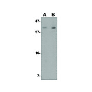 IRGM Antibody nterm 100µg