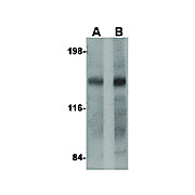 DISP2 Antibody cterm 100µg