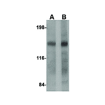 DISP2 Antibody cterm 100µg