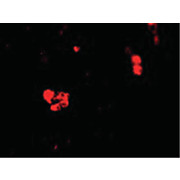 CIDE-B Antibody hu cterm 100µg