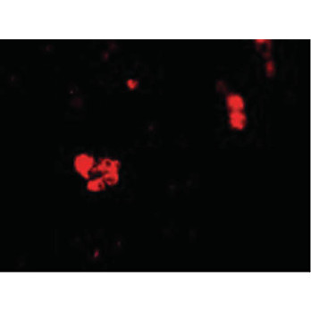 CIDE-B Antibody hu cterm 100µg