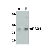 Anti-ESX1 (RABBIT) Antibody, 100µg, Liquid (sterile filtered)