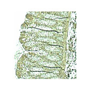 Anti-Pdcd4 (RABBIT) Antibody, 100µg, Liquid (sterile filtered)
