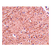 LASS5 Antibody nterm-14 100µg