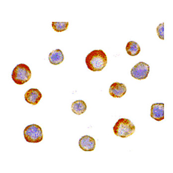 Anti-IKK gamma (RABBIT) Antibody, 100µg, Liquid (sterile filtered)
