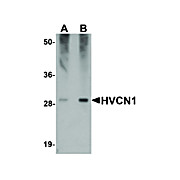 Anti-HVCN1 (RABBIT) Antibody, 100µg, Liquid (sterile filtered)