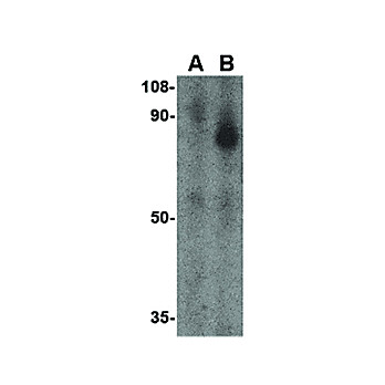 Anti-FEZ1 (RABBIT) Antibody, 100µg, Liquid (sterile filtered)