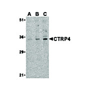 CTRP4 Antibody cterm 100µg