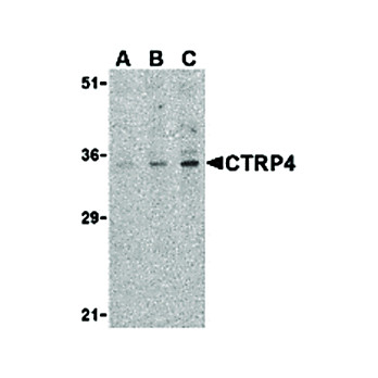 CTRP4 Antibody cterm 100µg