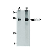 CDIP Antibody internal-16 100µg