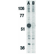 Anti-Caspase-12 (RABBIT) Antibody, 100µg, Liquid (sterile filtered)