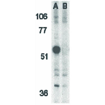 Anti-Caspase-12 (RABBIT) Antibody, 100µg, Liquid (sterile filtered)