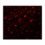 Anti-Girdin (RABBIT) Antibody, 100µg, Liquid (sterile filtered)