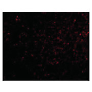 GRIK4 Antibody cterm 100µg