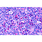 Anti-Caspase-3 (RABBIT) Antibody, 100µg, Liquid (sterile filtered)