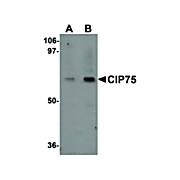 Anti-CIP75 (RABBIT) Antibody, 100µg, Liquid (sterile filtered)