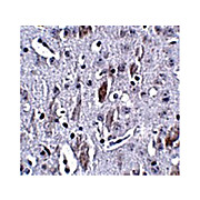 IL-16 Antibody (14) 100µg