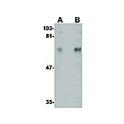 Anti-CPEB1 (RABBIT) Antibody, 100µg, Liquid (sterile filtered)