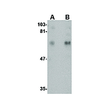 Anti-CPEB1 (RABBIT) Antibody, 100µg, Liquid (sterile filtered)