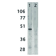 DC-SIGN Antibody 100µg