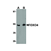 FOXO4 Antibody nterm 100µg