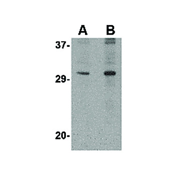 Anti-DNAL1 (RABBIT) Antibody, 100µg, Liquid (sterile filtered)