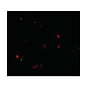 LASS5 Antibody cterm 100µg