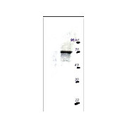 Anti-p70 S6 Kinase (RABBIT) Antibody, 100µg, Liquid (sterile filtered)