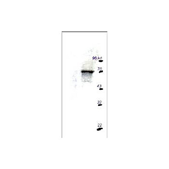 Anti-p70 S6 Kinase (RABBIT) Antibody, 100µg, Liquid (sterile filtered)