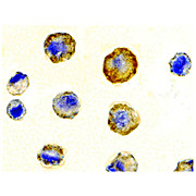 DcR1 Antibody extracellular 100µg