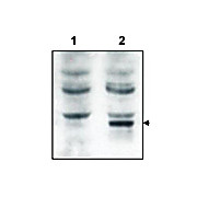 Anti-Tamalin (RABBIT) Antibody, 100µg, Liquid (sterile filtered)
