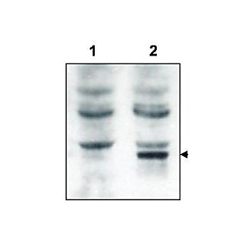 Anti-Tamalin (RABBIT) Antibody, 100µg, Liquid (sterile filtered)