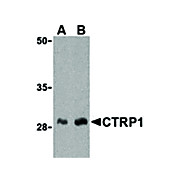 CTRP1 Antibody nterm 100µg
