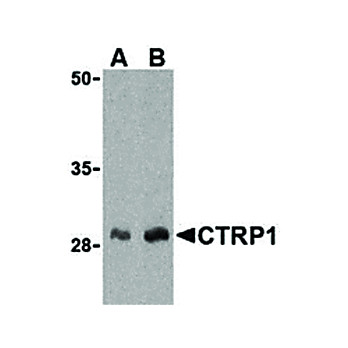 CTRP1 Antibody nterm 100µg
