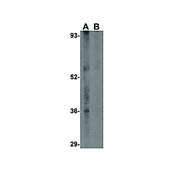 Anti-CCDC98 (RABBIT) Antibody, 100µg, Liquid (sterile filtered)