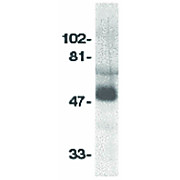 Anti-CCR8 (RABBIT) Antibody, 100µg, Liquid (sterile filtered)