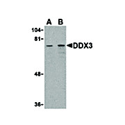 DDX3 Antibody internal 100µg